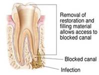 Endodontic Specialist of Oakhurst