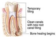 Endodontic Specialist of Oakhurst